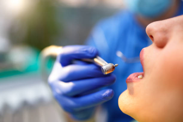 Dental Inlays and Onlays in Clinton, IN